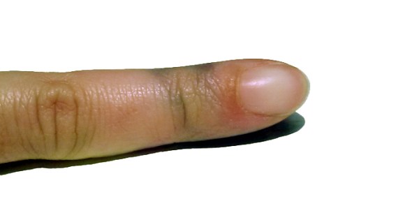 Traccce lasciate sulle dita dalla lavorazione di un filato all'indaco